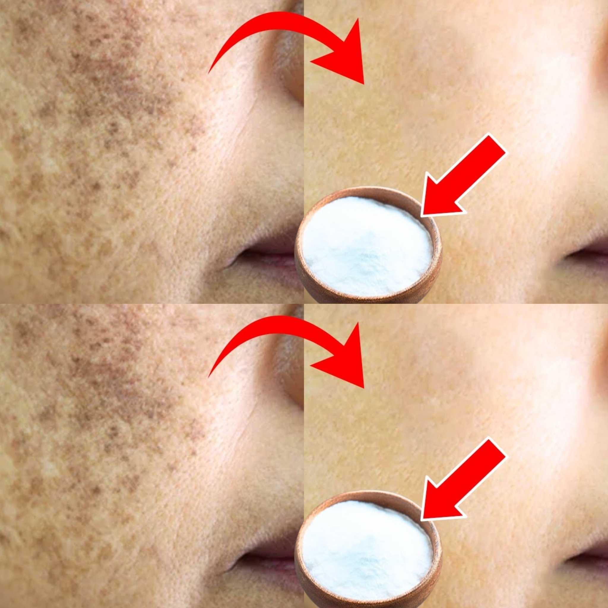 Erase Age Spots with a Simple Kitchen Staple: Baking Soda