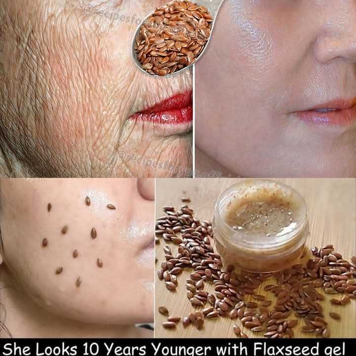 Even If You Are 70, Apply This Flaxseed Remedy to Wrinkles: Taut Skin Like Glass—Stronger Than Botox!