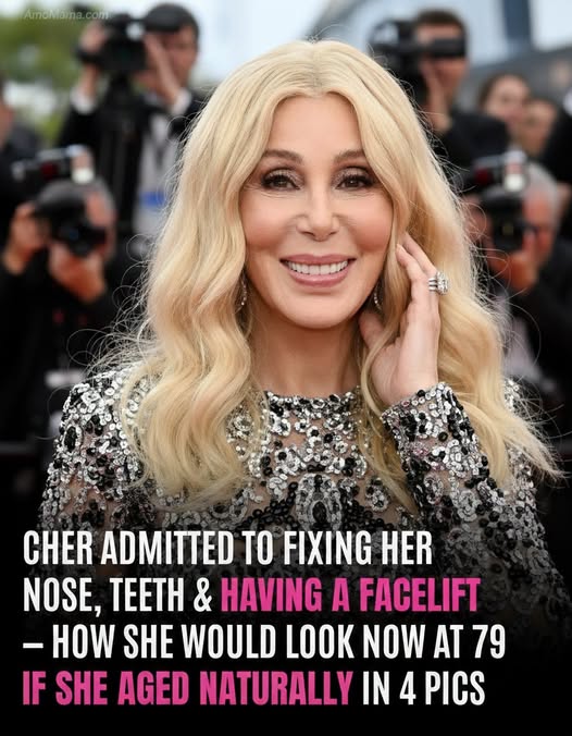 Cher Previously Discussed Having a Facelift – How She Looks Now at 79 and How AI Thinks She’d Look Naturally – Internship News