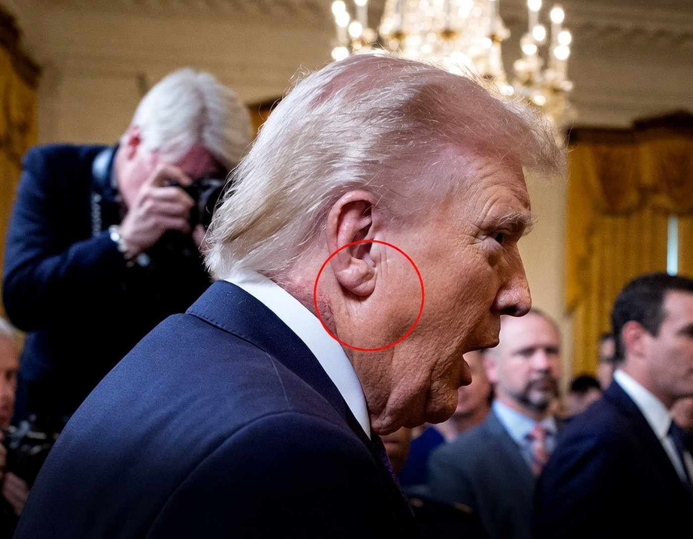 ‘Frank’s Sign’ on Trump’s ear could be huge indicator of potentially fatal health condition – usanews.net